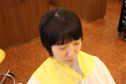 事例：前髪の割れを改善 AFTER
